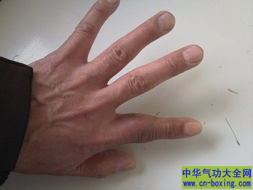 如何通过指甲检视自己的身体状况