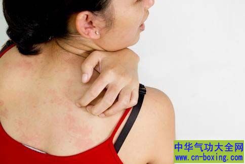 为什么看别人抓痒自己也痒？