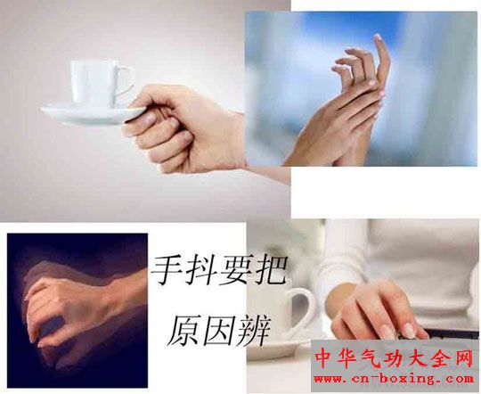 中青年手抖 甲亢可能性大 
