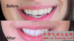 二分钟让牙齿变得洁白靓丽